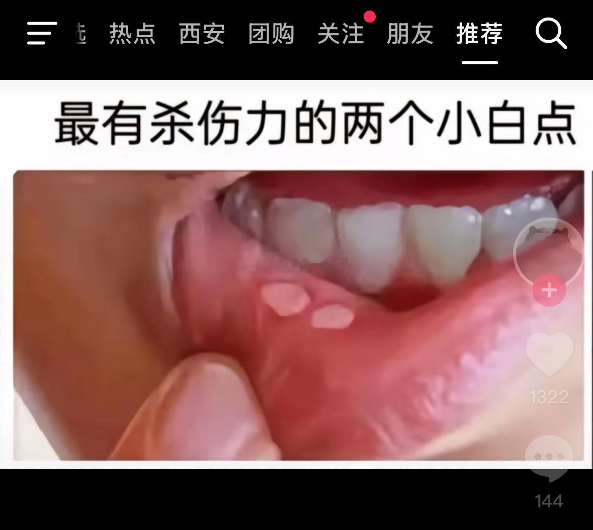 别提了看了就来气！​​​