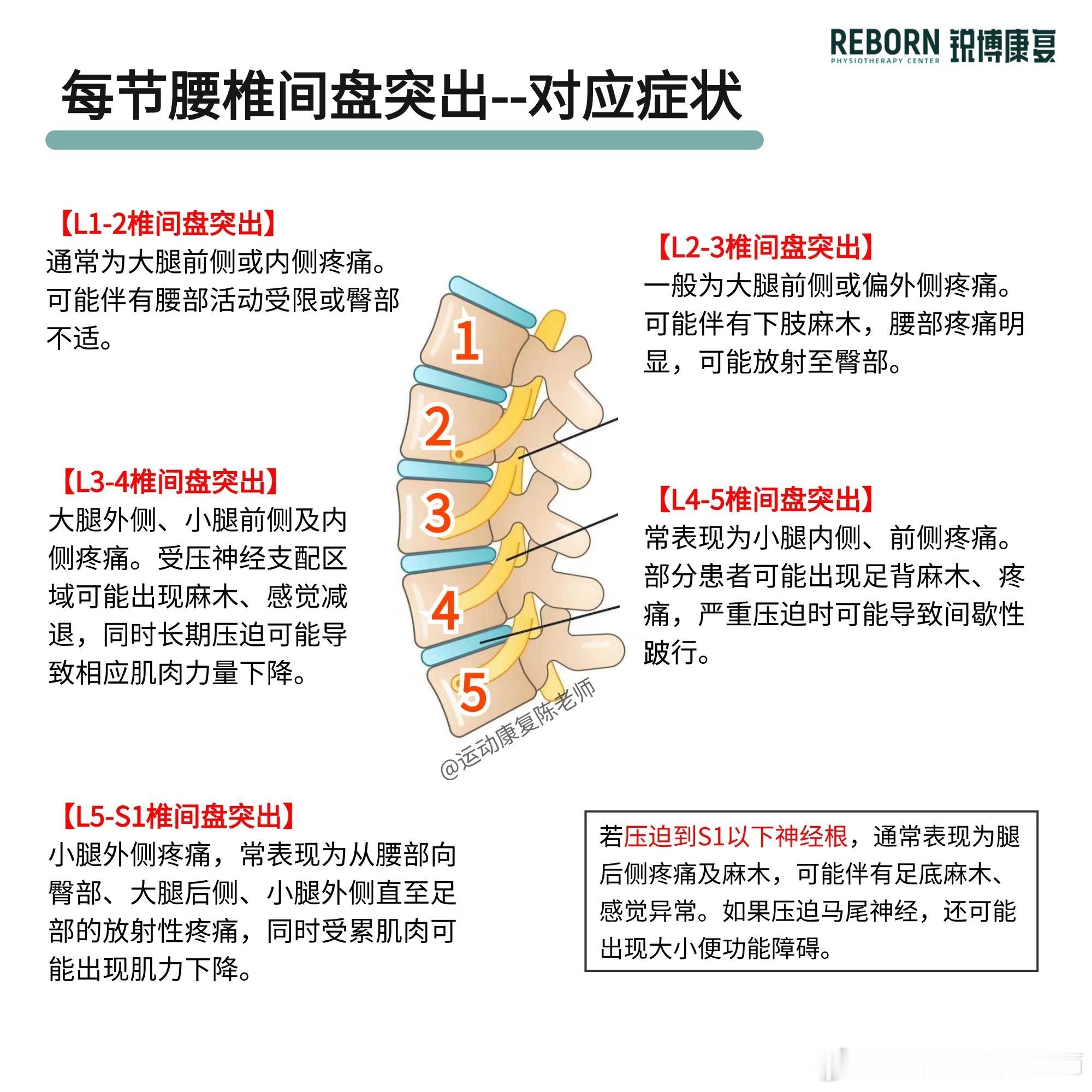 腰椎间盘突出【一张图带你了解腰突症状】不同腰椎间盘的突出，引发疼痛的位置、神经