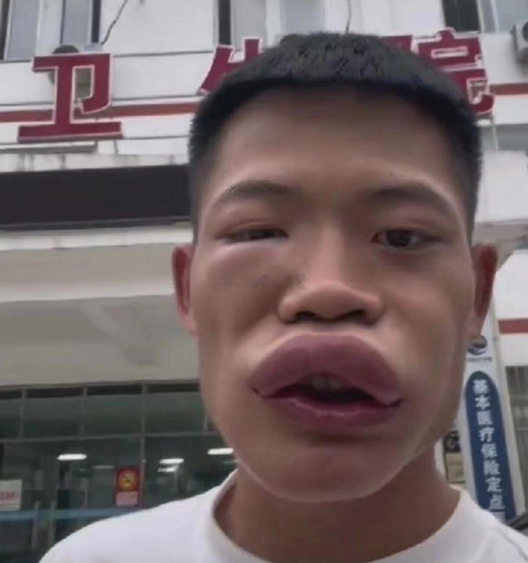 我有补充。这位男子的行为，堪称一场集责任感缺失、法律意识淡薄与风险认知错位于一体