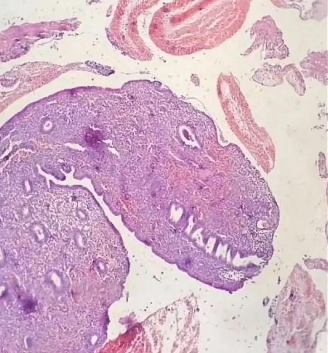 显微镜观察到的！请问这是什么组织？