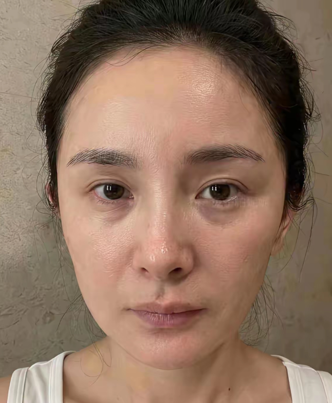 杨幂的黑眼圈很重毛孔粗大细纹不是很明显，没有鱼尾纹，总体还是保养的不错，要说多