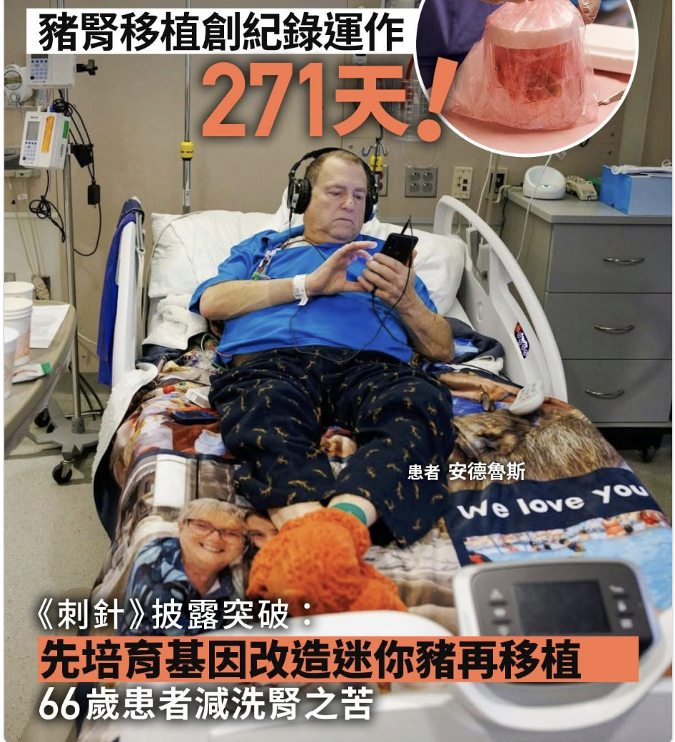 美国医师表示，一颗猪肾移植到患者体内后运作了271天，创下有纪录以来最长时间。尽管这颗猪肾最终失去功