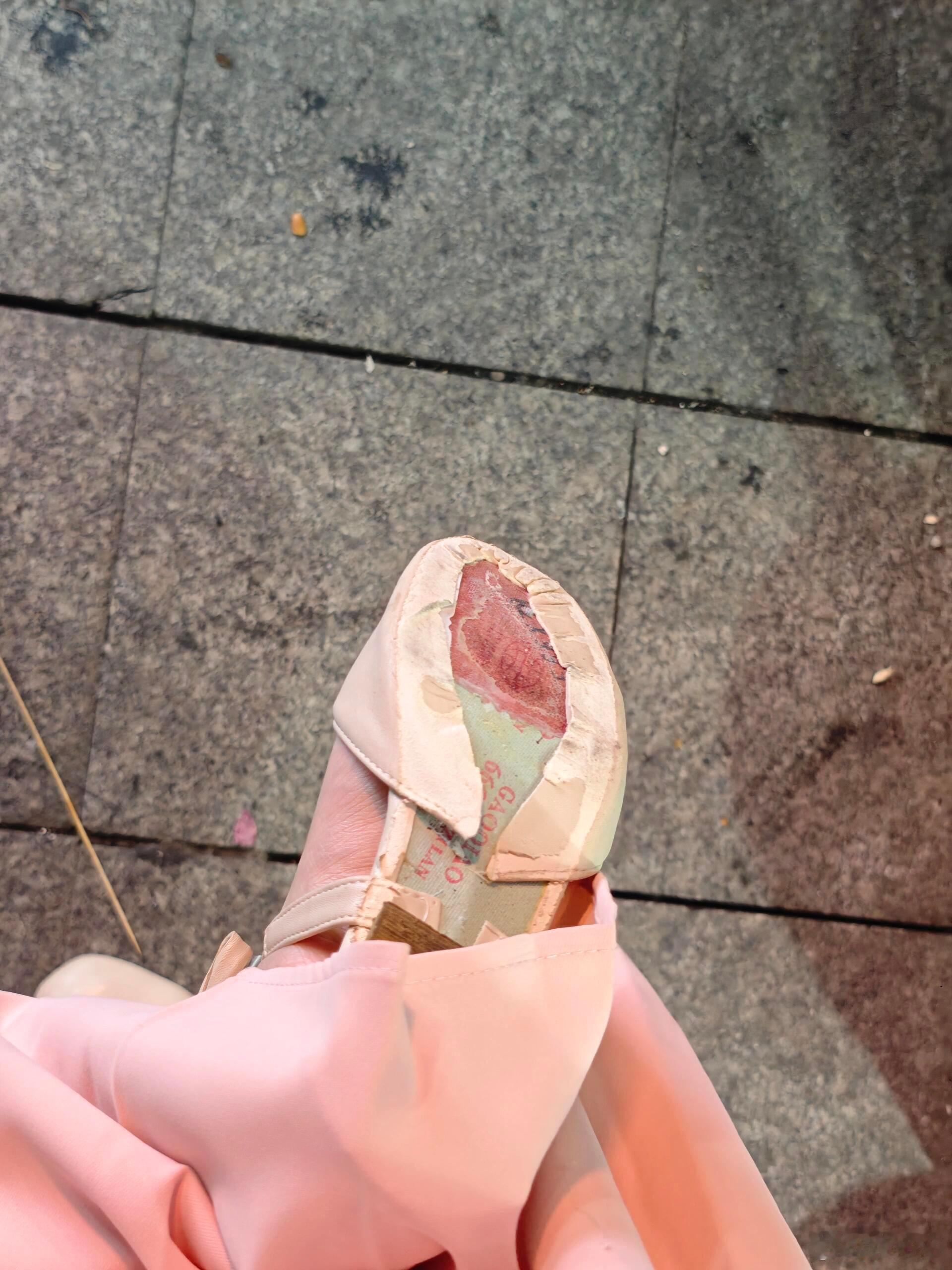 放太久的鞋子不要轻易穿出门​​​