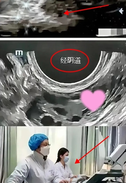 苏州医院“阴超”事件，震碎三观！5月30日，王女士去苏州市立医院东区做腹部B