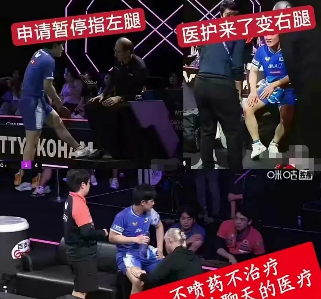 张本智和这个神奇的医疗暂停，确实引入争议。比赛的时候对着裁判指着左腿，治疗的时
