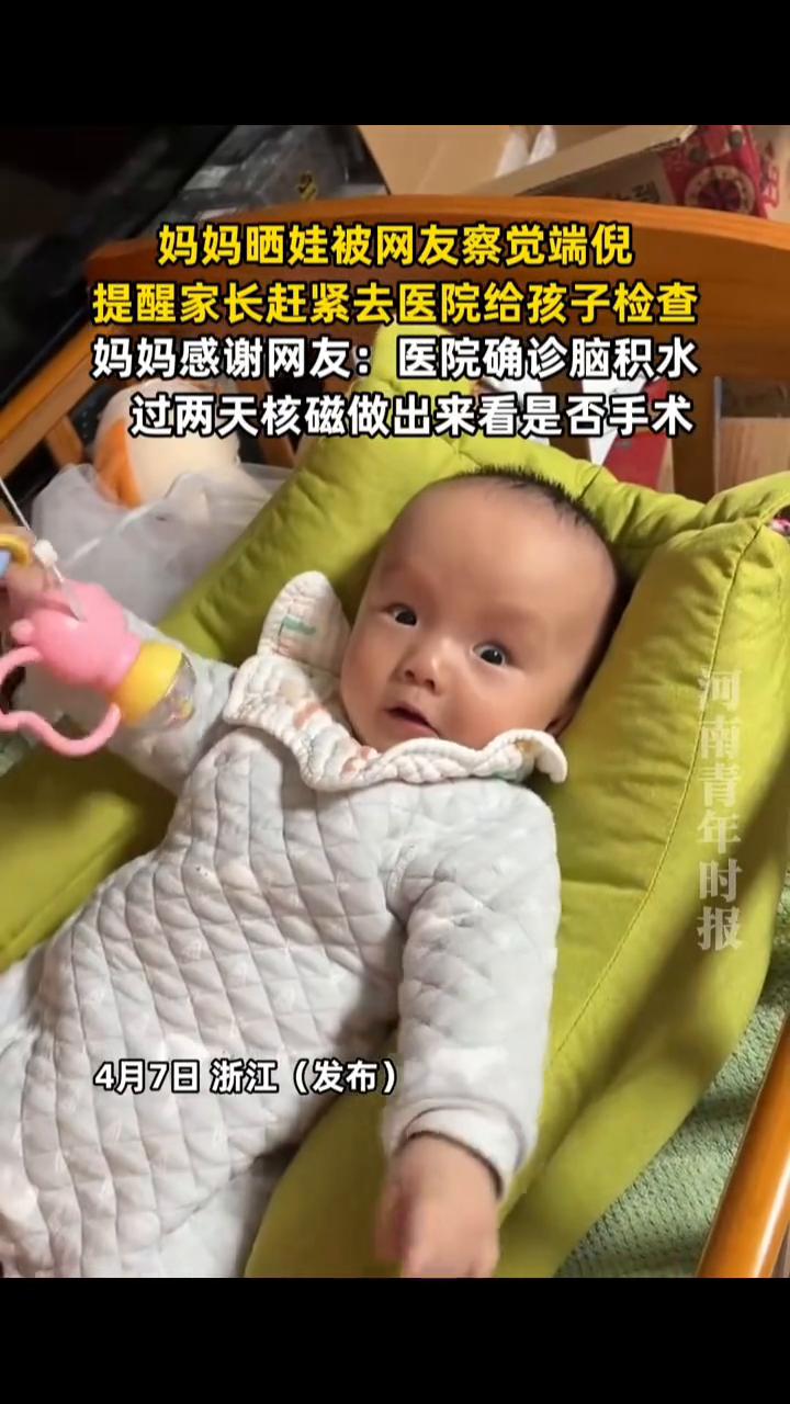 妈妈晒娃被网友察觉端倪，提醒家长赶紧去医院给孩子检查。河南青年时报。妈妈感谢