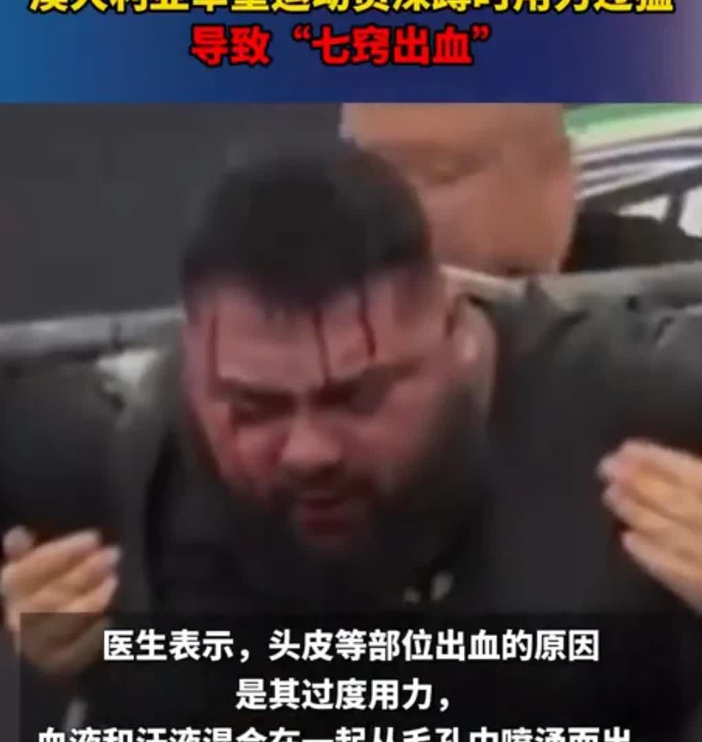 真是太吓人了。举重一定要量力而行。8月2日澳大利亚，一名举重运动员深蹲时