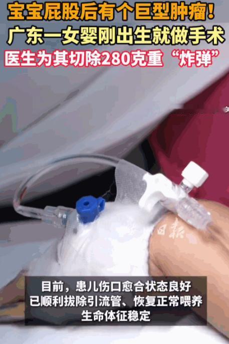 可怜天下父母心！广东深圳，一位孕妈在产检时惊觉胎儿屁股上长了个不该长的大疙瘩，全