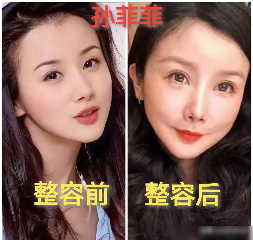 国民闺女杨紫的脸，才30出头就僵硬得像蔡明？资源咖如今也无戏可拍？从《香蜜