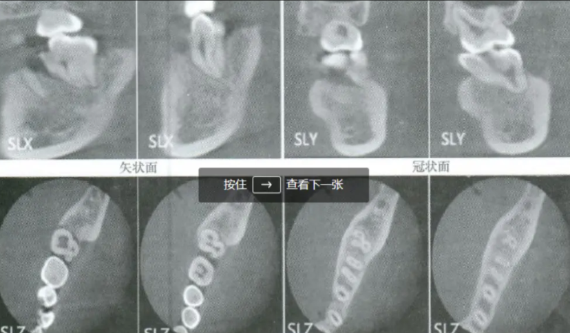 “离了个大谱！”4月11日，陕西榆林，一男子在星级酒店用餐时，突然被一颗小石子“
