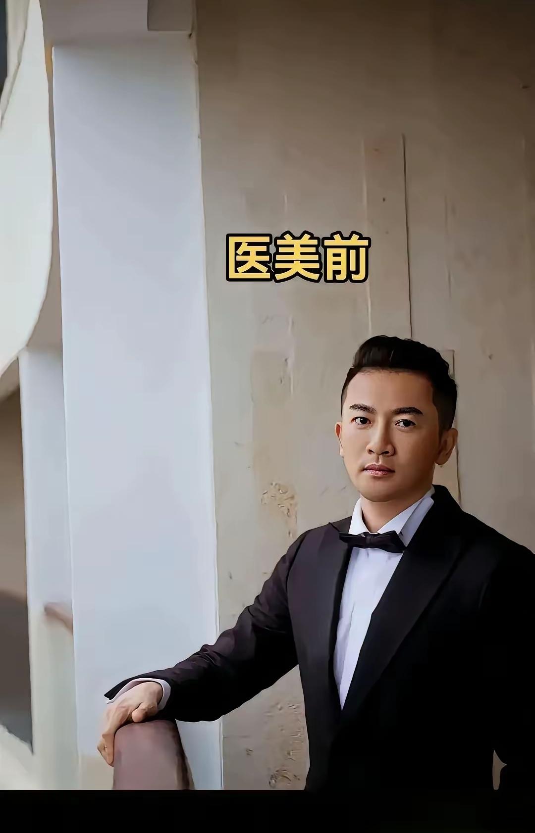 天哪，整容太可怕啦！连明星整容都成了这副模样，你说说咱们普通人还敢整吗？他们