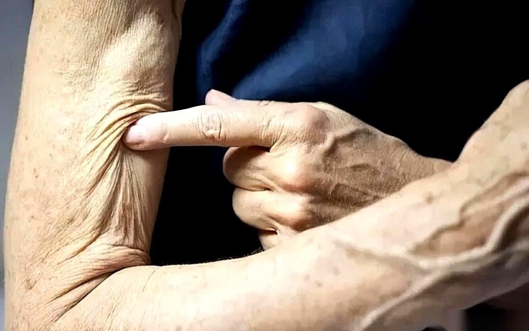 很多人都搞错了，55岁以后，肌肉的流失根本不是慢慢变弱，它更像一场无声的雪崩。