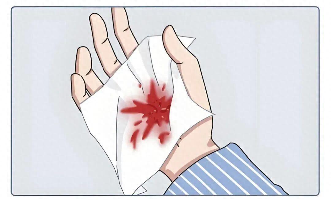 浙江男子用筷子在卫生间捅了一下，当场被120拉走。🤫“老头子！你怎么了？