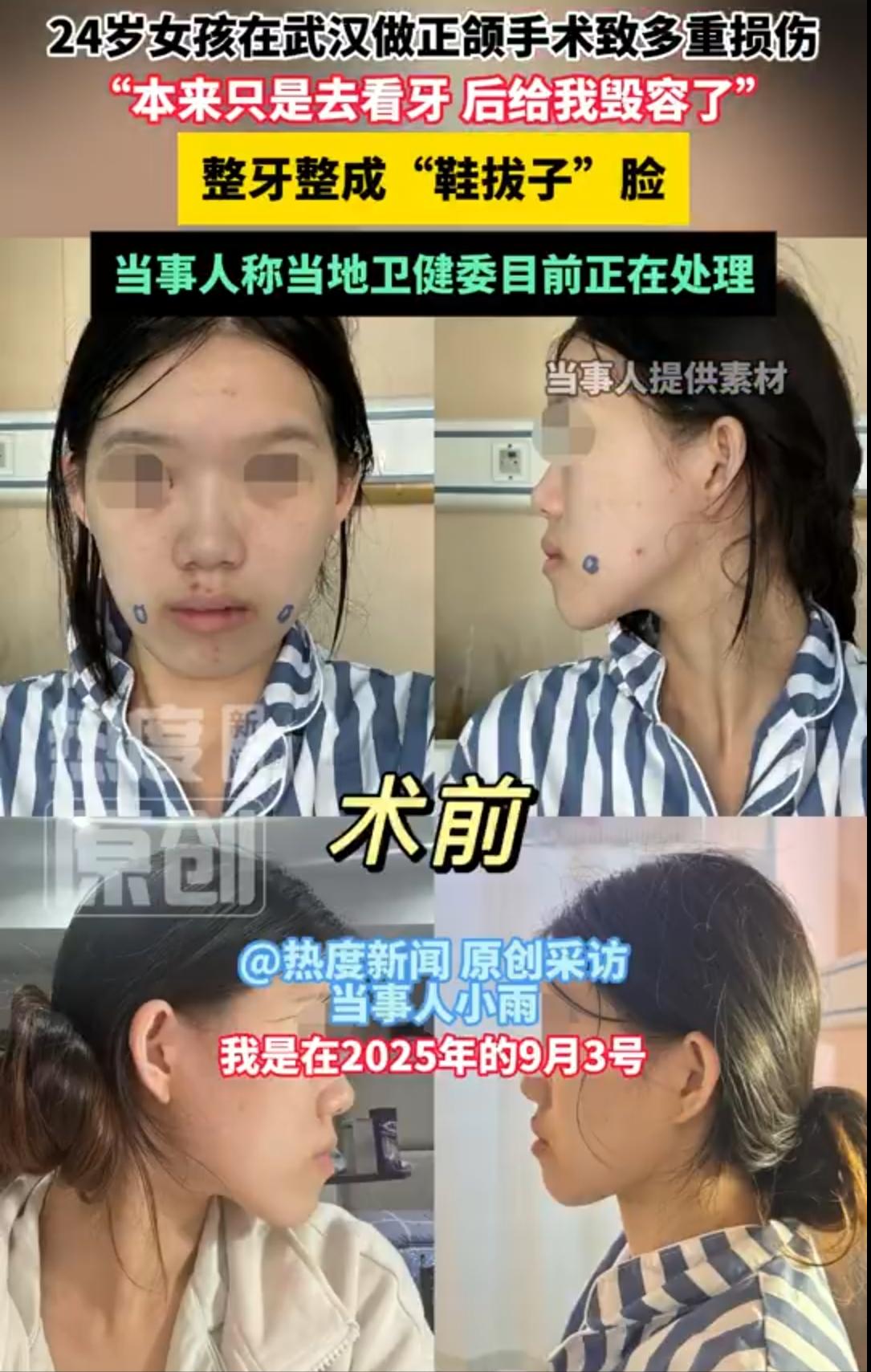 建议谁能想到？只是去医院看牙，却被建议做骨骼大手术！武汉一名24岁女孩亲身经历这