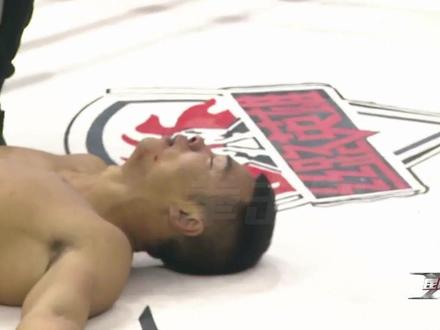 职业拳坛最戏剧性一幕，打完比赛双双晕倒，老外需要插氧抢救治疗