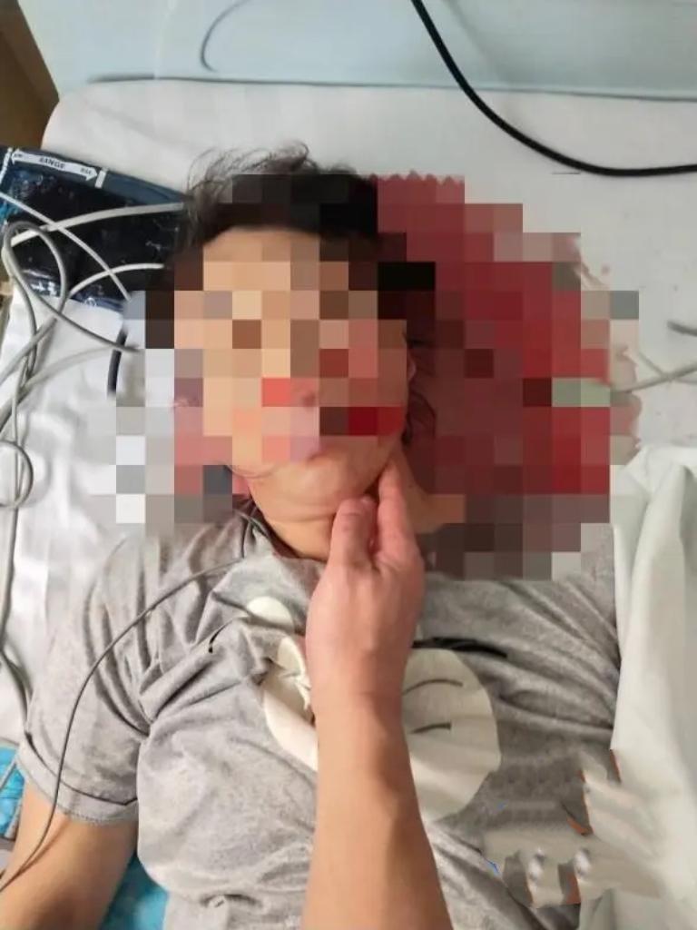 2025年4月，江苏南通宋女士因胃病就诊，却被建议做心脏微创手术，术后不幸身亡。