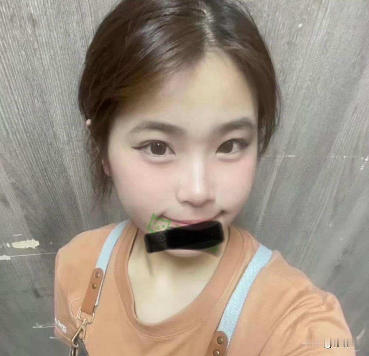49万手术费‼️在四川党岭徒步，因严重高原反应休克失温的姑娘，情况很不乐观！如