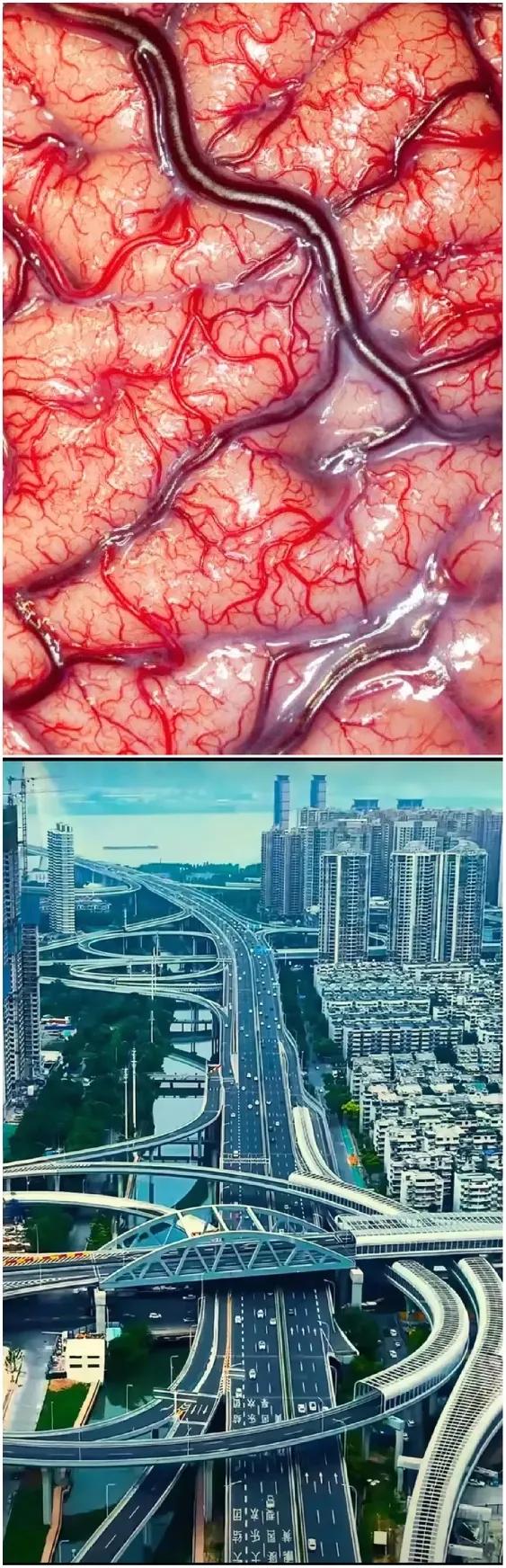 血管畸形！[无奈吐舌]血压高的，建议看看！一个城市，千万人口在里面生活，如果没