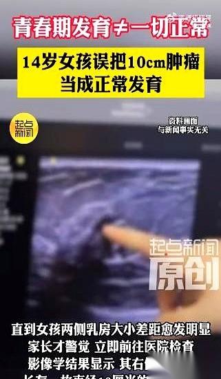 西安一个14岁女孩洗澡，手无意中滑过右胸，摸到一个硬块。她告诉家里人，得到一句