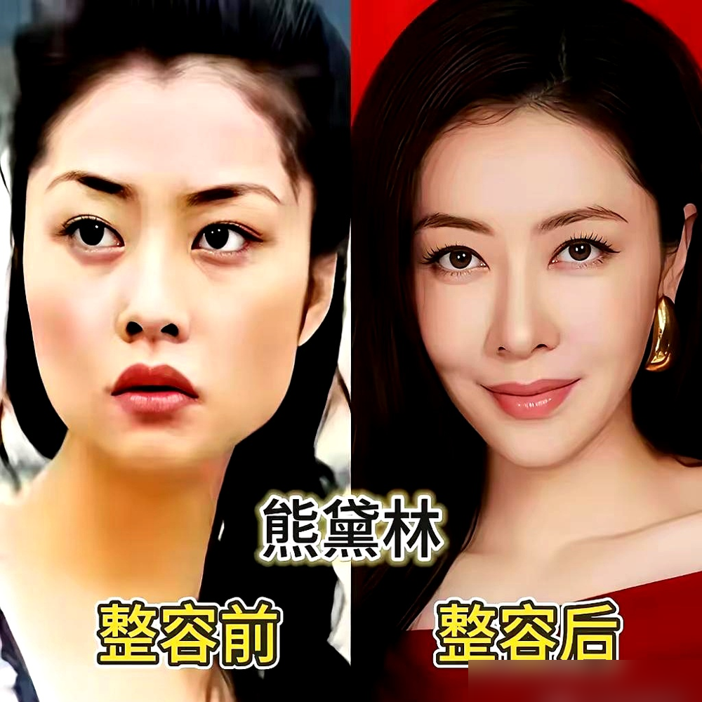 沈梦辰在节目里直接撂了：对，我微调了，每天都在调，怎么了？原话比这还松弛。她说自己连续四年做热玛吉，