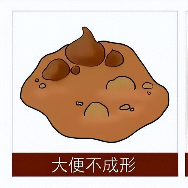 长期大便不成形，根本原因可不是消化不良，而是它！ 很多人长期大便细软不成形，