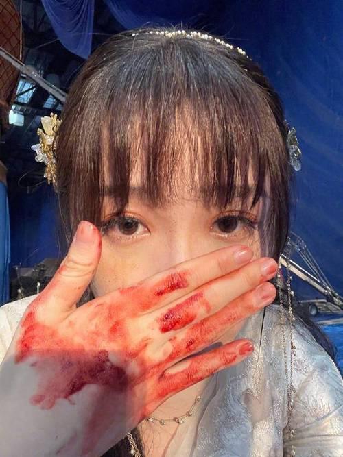 5月12日，张婉婷被曝在粉丝群发布疑似割腕的照片与相关录音，瞬间引发舆论热议。目