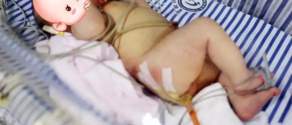 29岁孕妈顺产出足月男宝，一家人还没来得及开心，接生医生翻开宝宝下身瞬间傻眼：孩