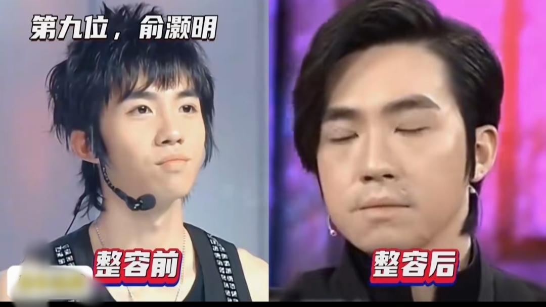 俞灏明与胡歌都历经意外容颜受损，后续做了修复调整，容貌虽得以恢复，却再也找不回年