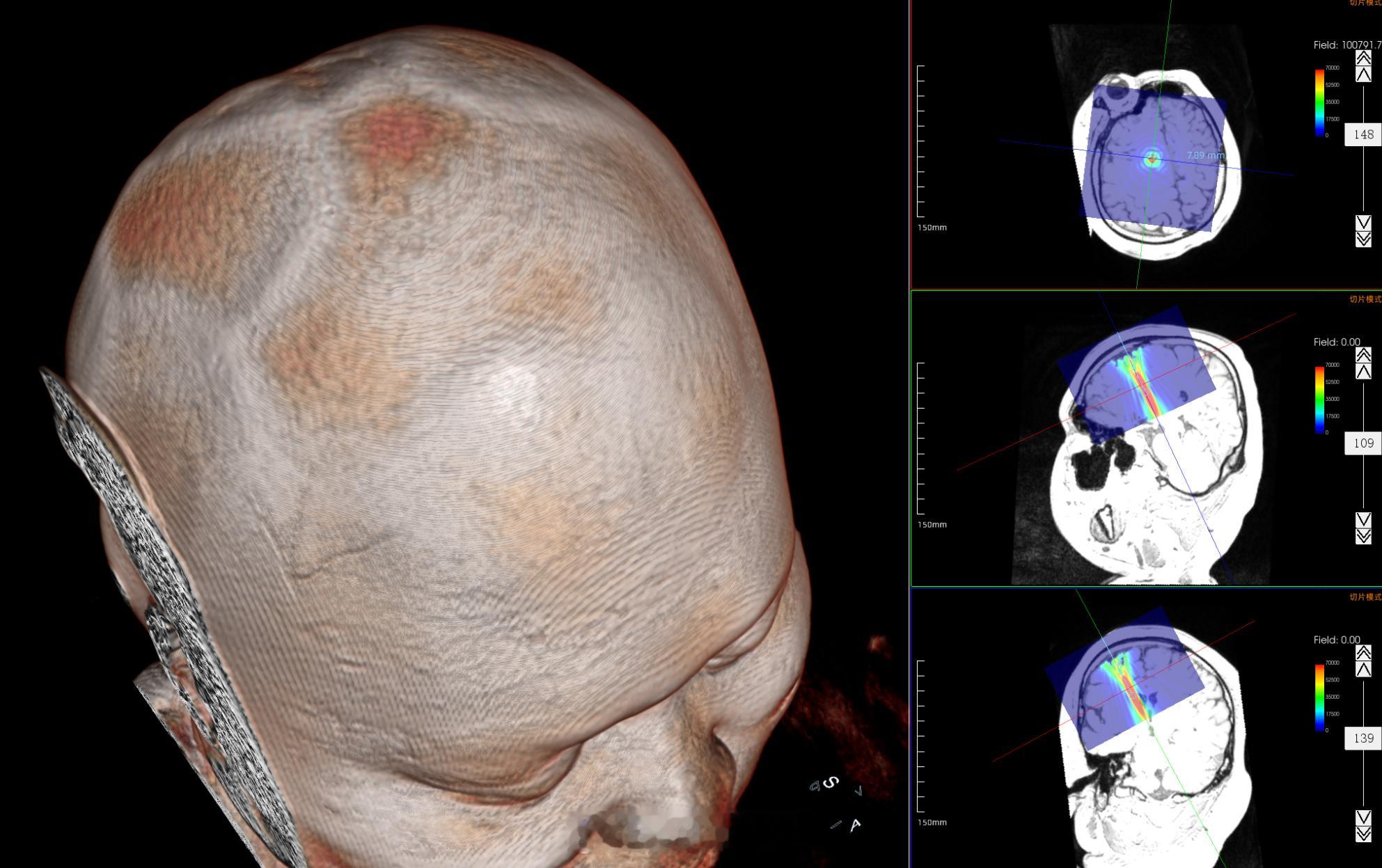 半个月的成果，累死了
