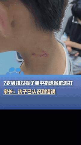 这就是手欠的后果！贵州一位小男孩跟着外婆去黔灵山动物园游玩，在看猴子的时候，小男
