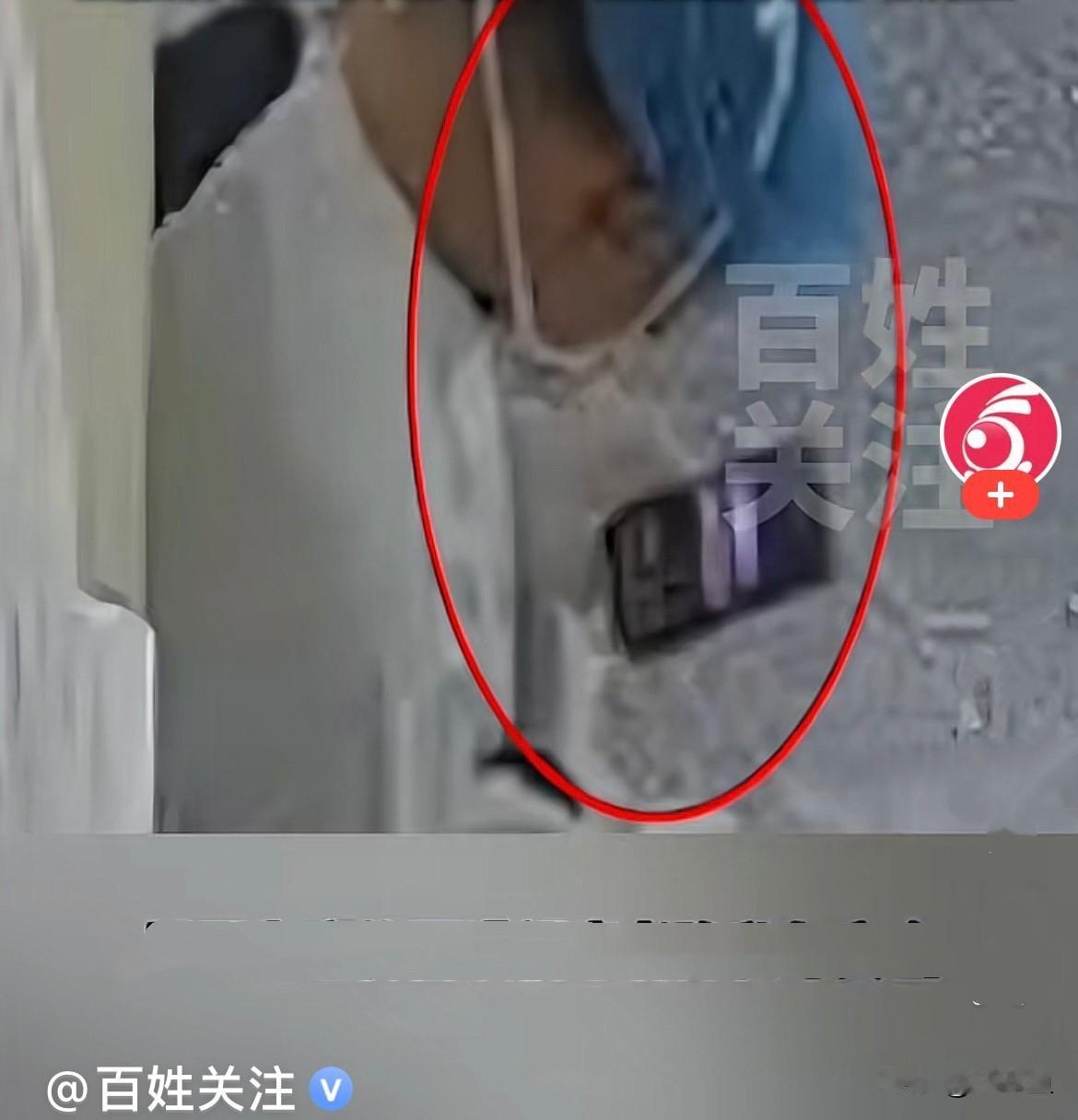 近日，西安刘先生的妻子，年仅37岁，因做气管镜检查。谁也没想到，一场普通的常规