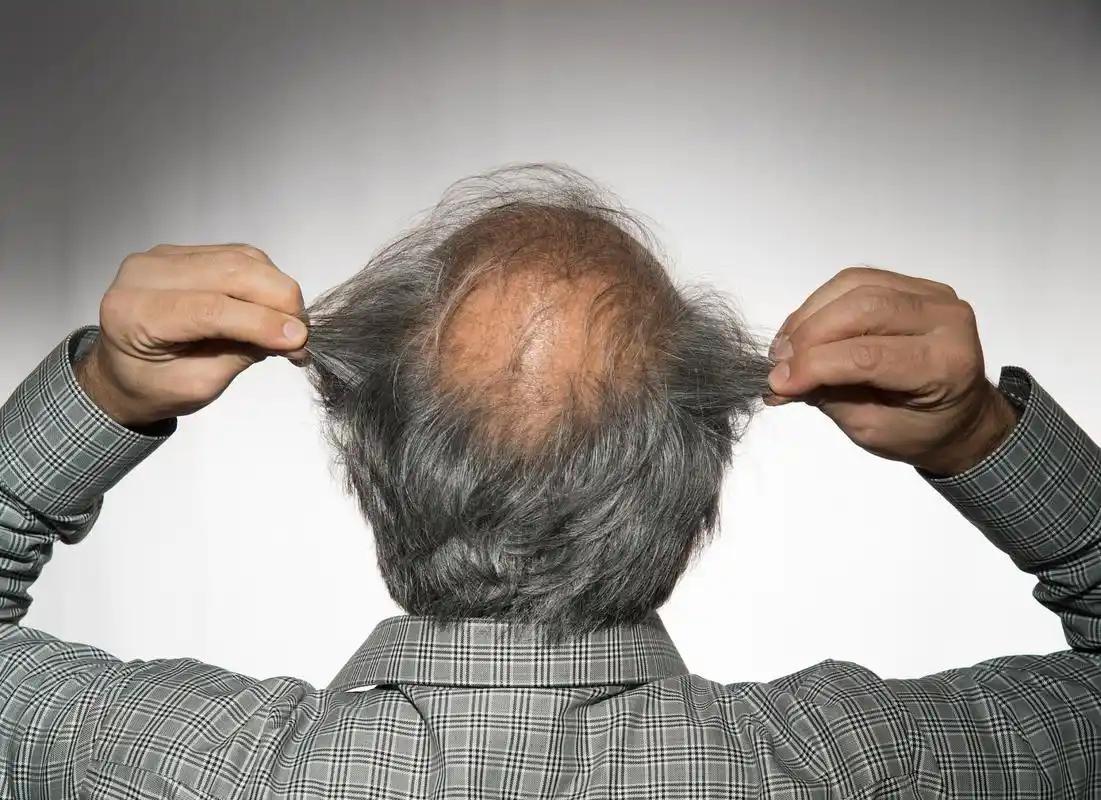 男性能活多久，看头发就知？提醒：若有这3症状，尽早引起重视！很多男性三十岁刚