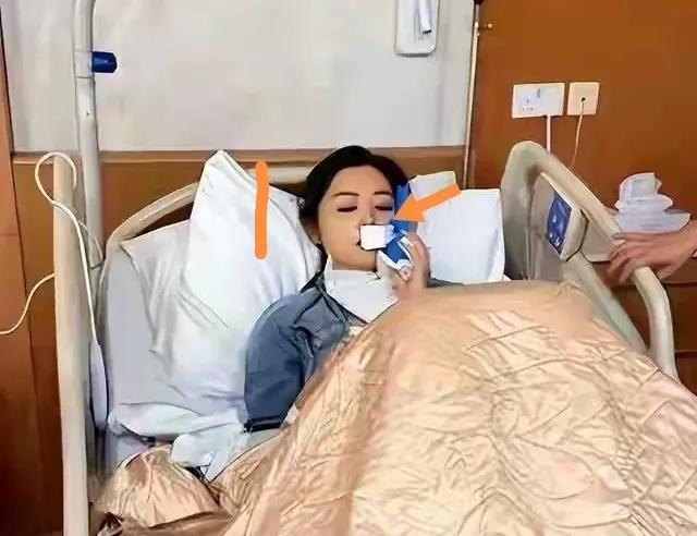卫诗雅获奖前后对比：图1：卫诗雅获奖前一天因拍戏嘴唇玻璃划伤缝合五十多针才拆线