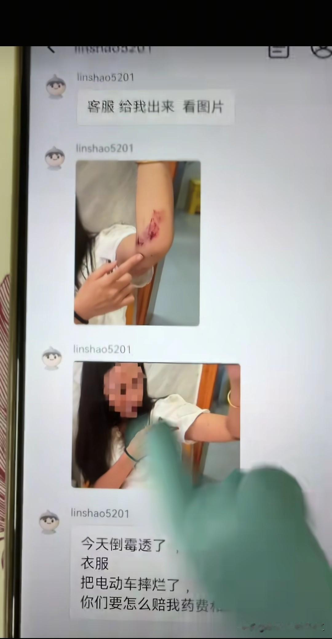 网友，客服出来，今天穿了你家的衣服电动车都摔烂了，人也磕了，衣服也破了，倒霉透了