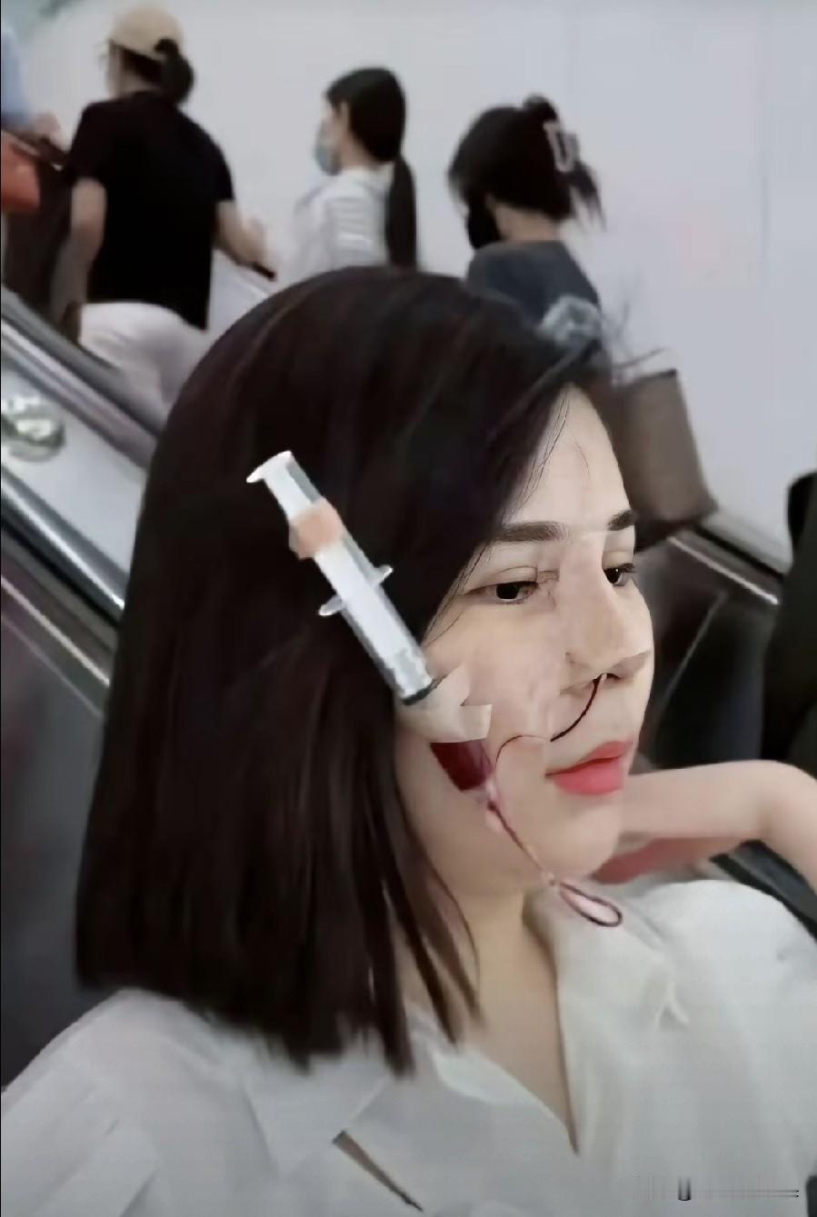 这也太吓人了，为了变成自己心目中的美女，真的是拼了。外出公共场所，针管都不用拔