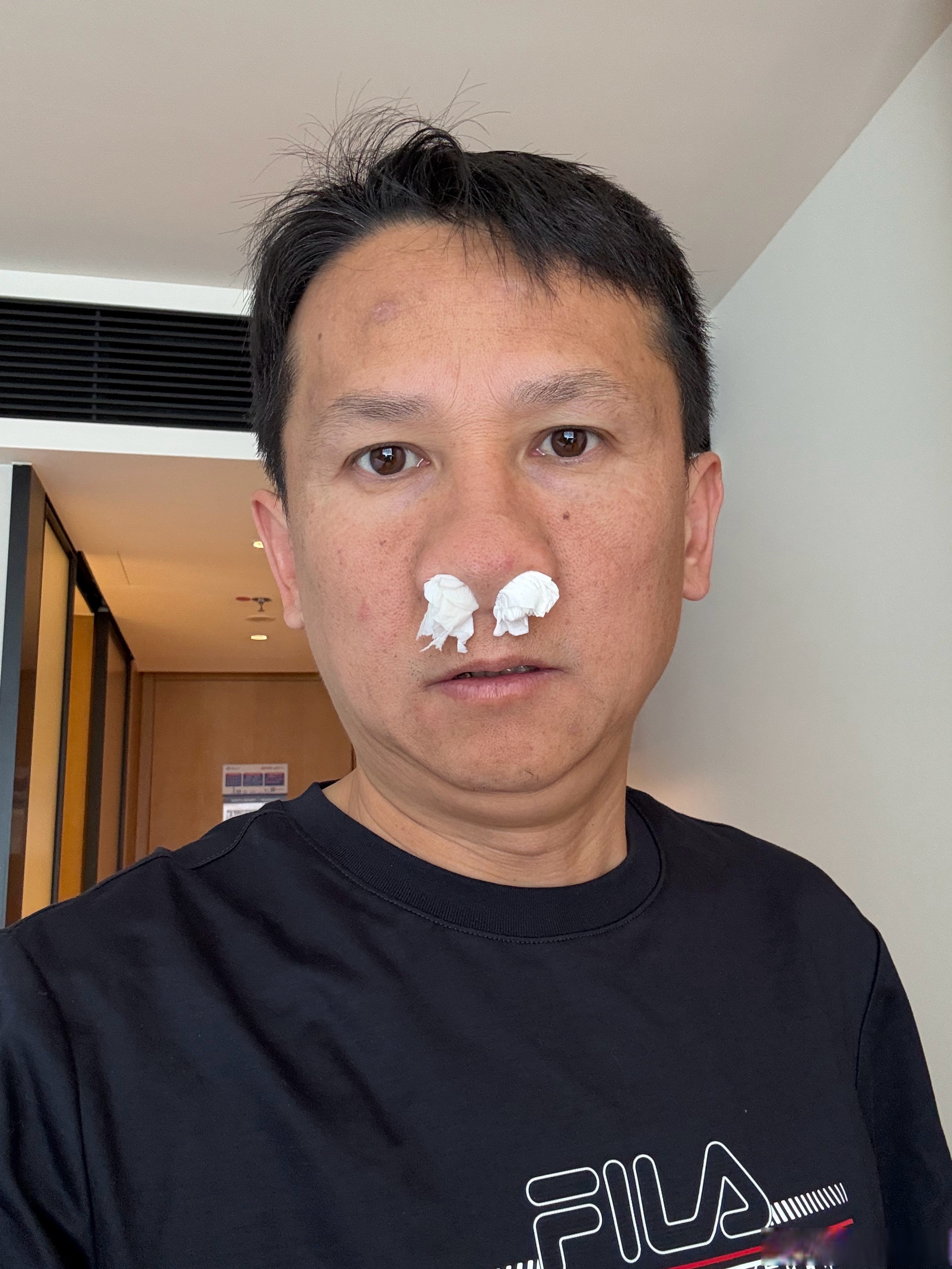 过敏性鼻炎，本质是卫气不固，营卫不和过敏性鼻炎，中医叫鼻鼽。很多人年年反复打喷嚏