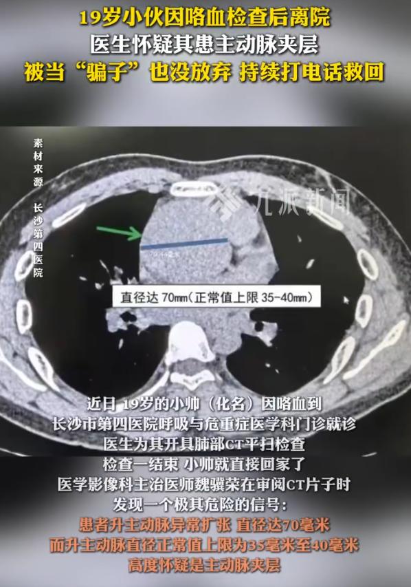 这位医生火了！湖南长沙，一名19岁小伙在家中咯血，随后立刻去医院做了检查，谁知拍