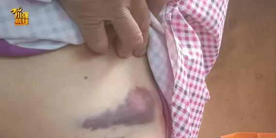 “防不胜防！”5月14日，浙江诸暨，一女子上班路上，遇到一名男子牵着大狼狗过来，
