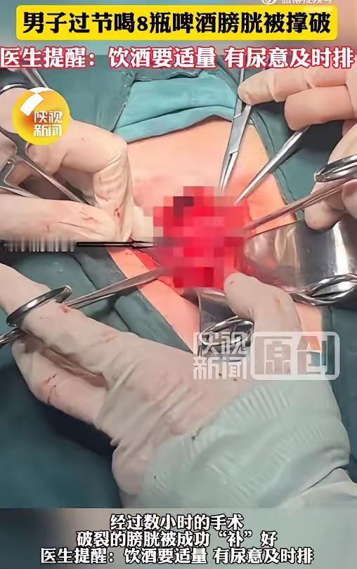 陕西一男子和朋友喝酒，连喝8瓶都没上厕所，回到家发现明明想撒尿却尿不出来了，去医