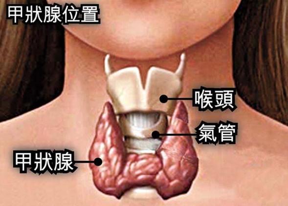 脱发, 罪魁祸首是甲状腺