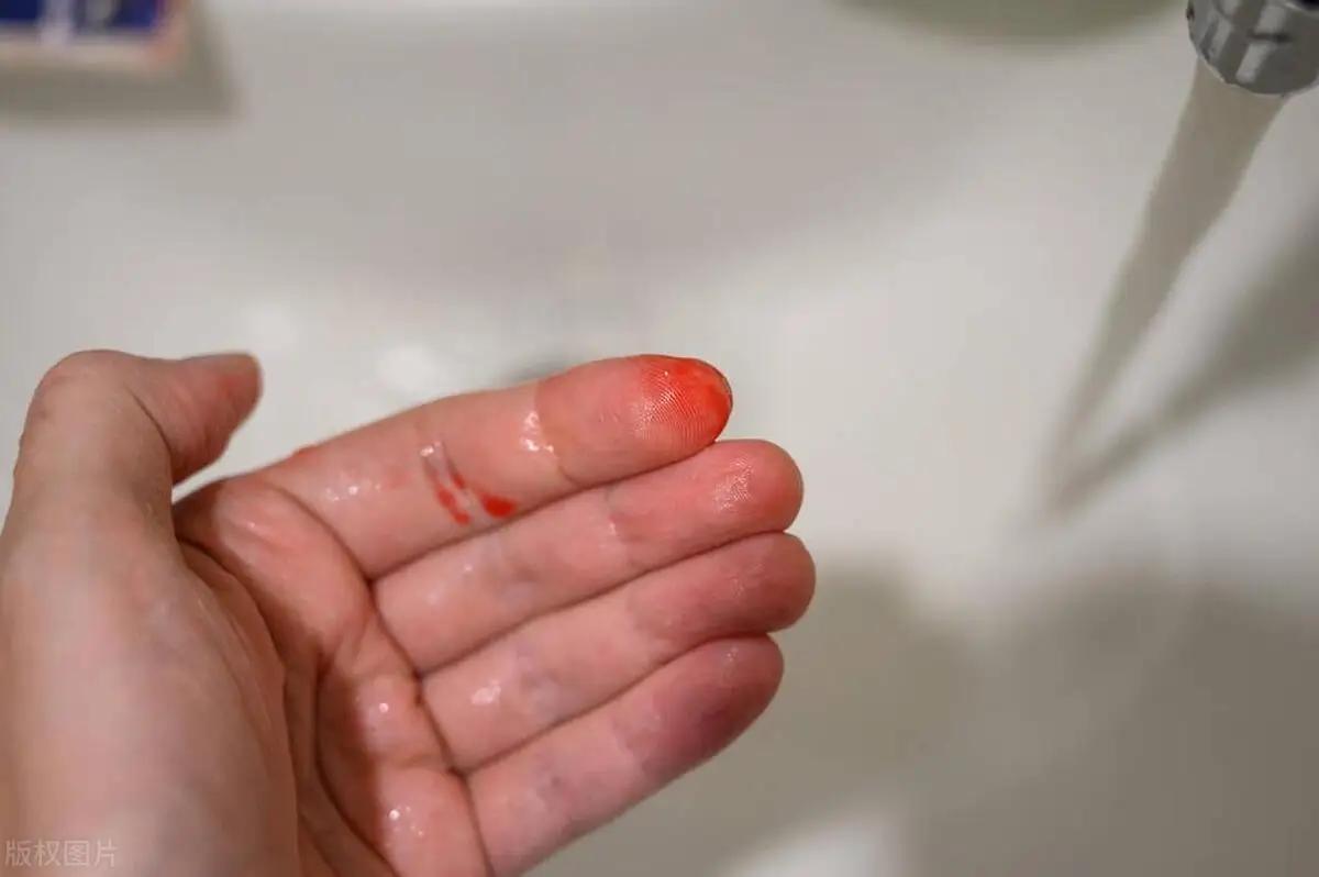 围绝经期异常出血，别让“小信号”拖成“大悲剧”！围绝经期的身体信号从不是小事，