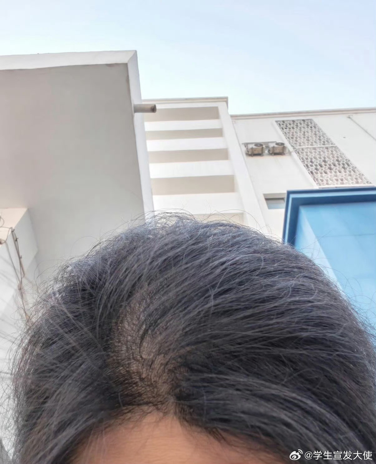 因为头发被辞了