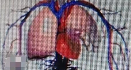 血压高于160/110的宝子看过来，有个简单方法花两分钟就能学会。我大伯之前血压