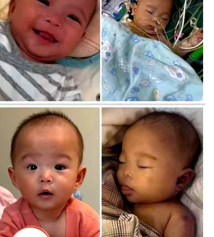 小洛熙，才五个月的小宝贝，因为“心房隔圆孔”医生建议手术，本来两个小时左右的手术