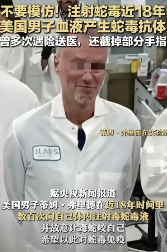 太狠了，美国一男子家中养了数十条毒蛇，18年间为了抵抗蛇毒，男子竟数百次向体内注