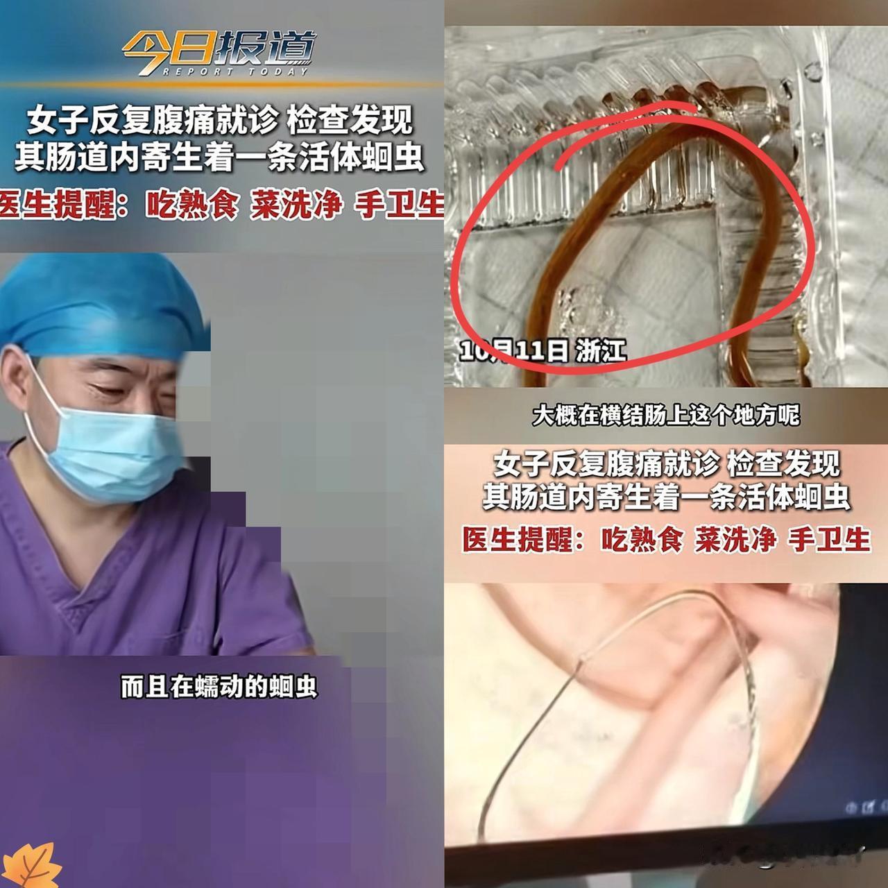 浙江金华，40多岁王女士腹痛，她以为是拉肚子，没在意，结果吃药后还是反复腹痛，只