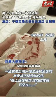 倒大霉了！上海男子酒店睡觉被“咬耳”，酒店回应太离谱真的离大谱！上海这哥们