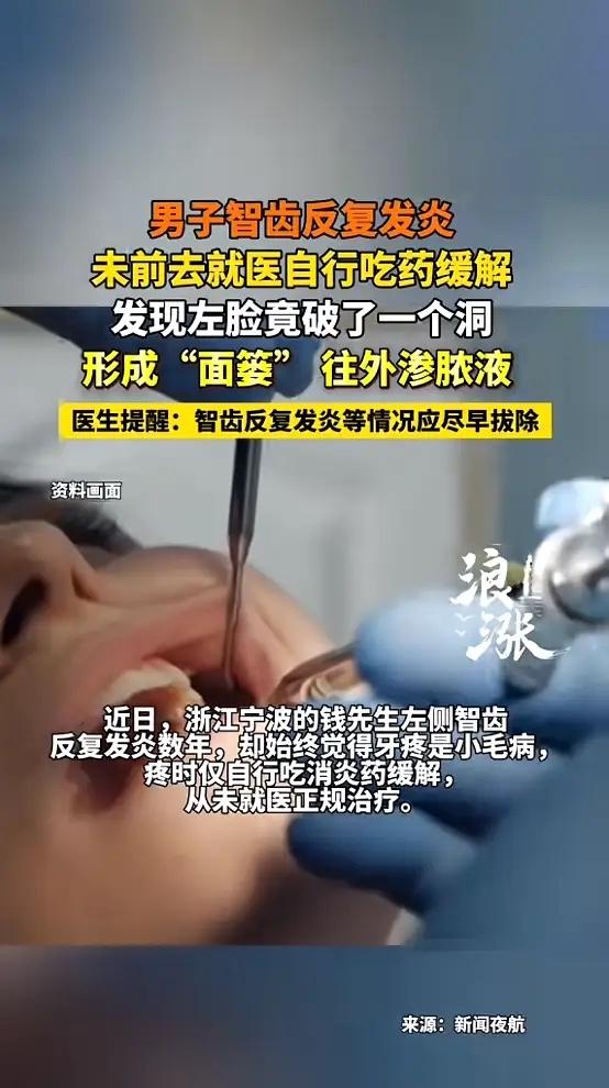 “悲剧还是发生了！”浙江宁波，一男子智齿反复发炎数年，他却始终觉得是小毛病，疼的