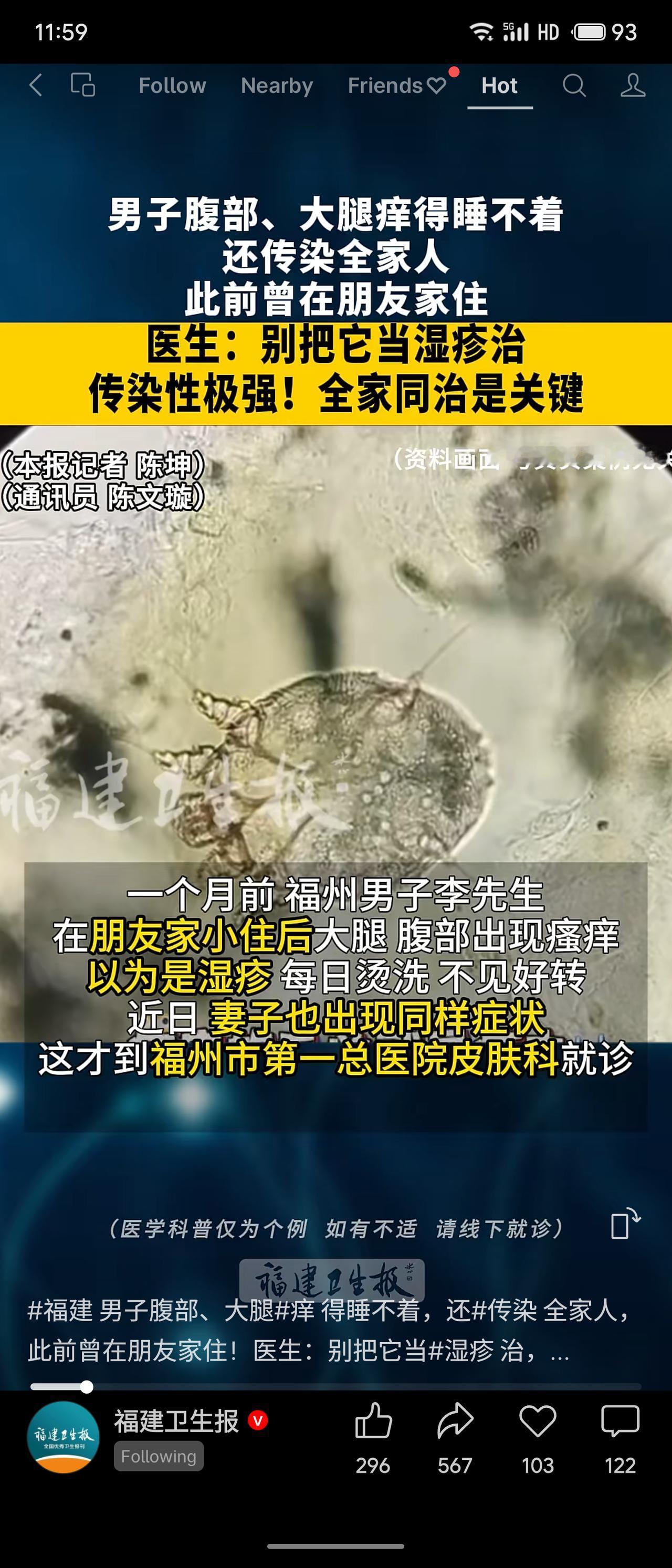 福州男子因疥疮误当湿疹，热水烫洗加重，传染全家。医生确诊疥螨感染，强调三管齐下：
