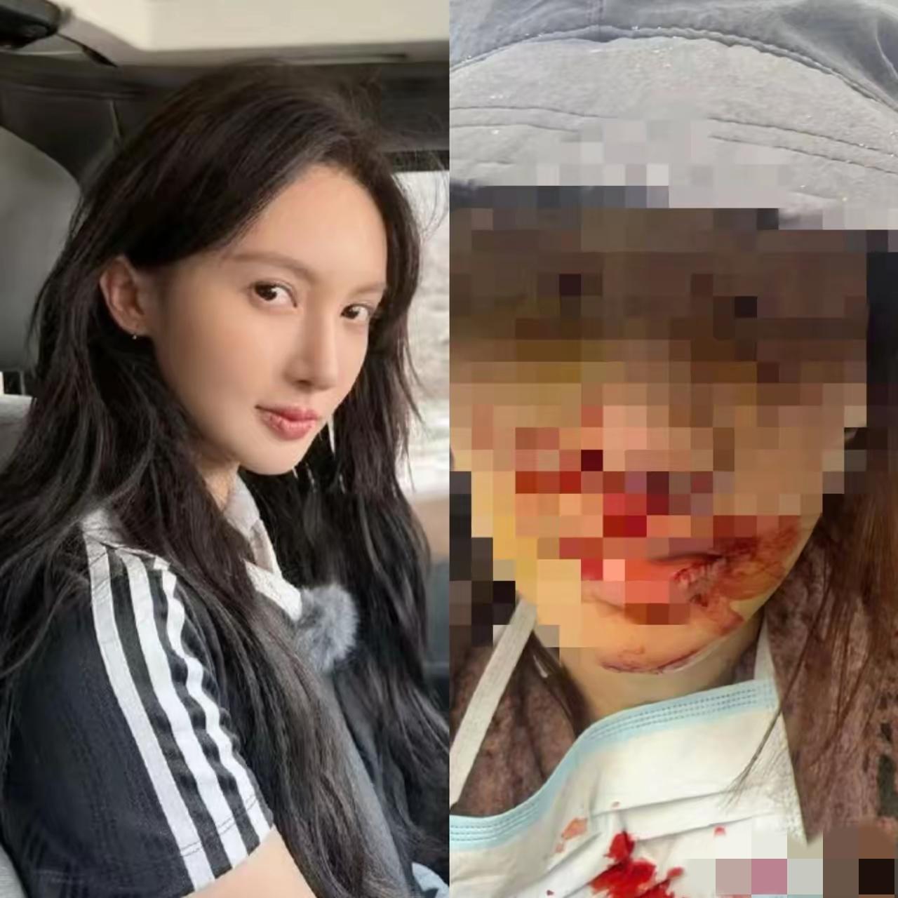 我问在美容院上班的表姐，金晨撞伤了脸为什么不在当地医院就诊，而是要舍近求远地和经